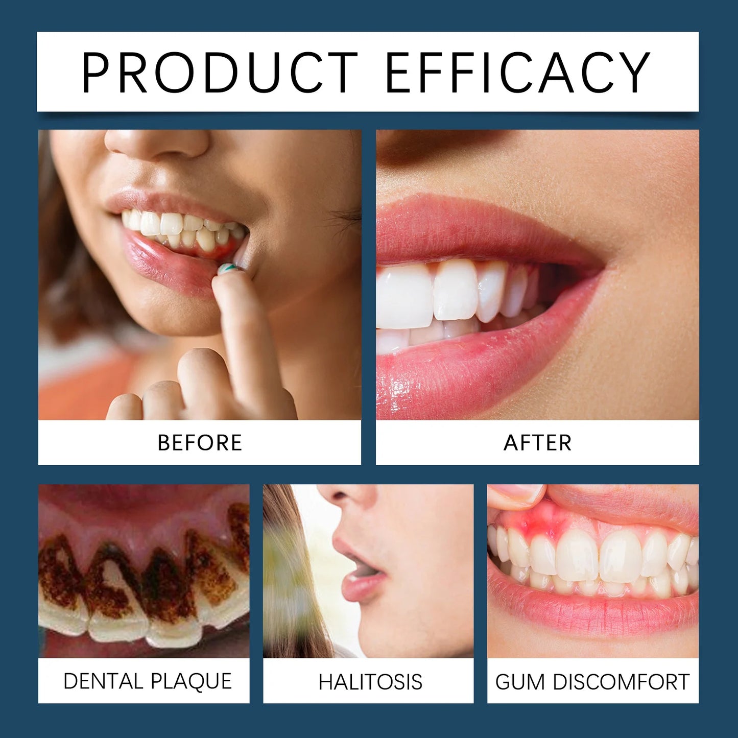 Gums Repair Gel Effectively Relieve Tooth Allergy Dental Caries Tooth Cleaning Toothpaste Relieve Tooth Damage Serum