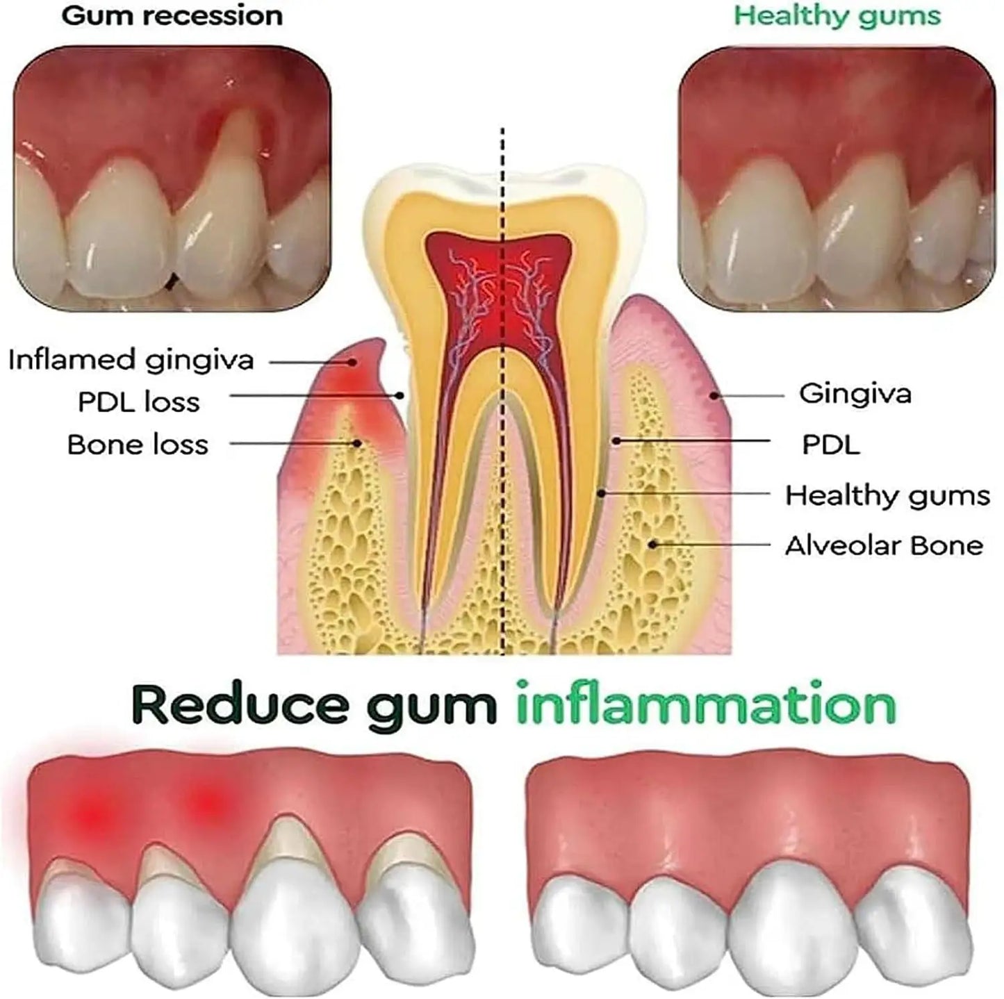 Gums Repair Gel Effectively Relieve Tooth Allergy Dental Caries Tooth Cleaning Toothpaste Relieve Tooth Damage Serum