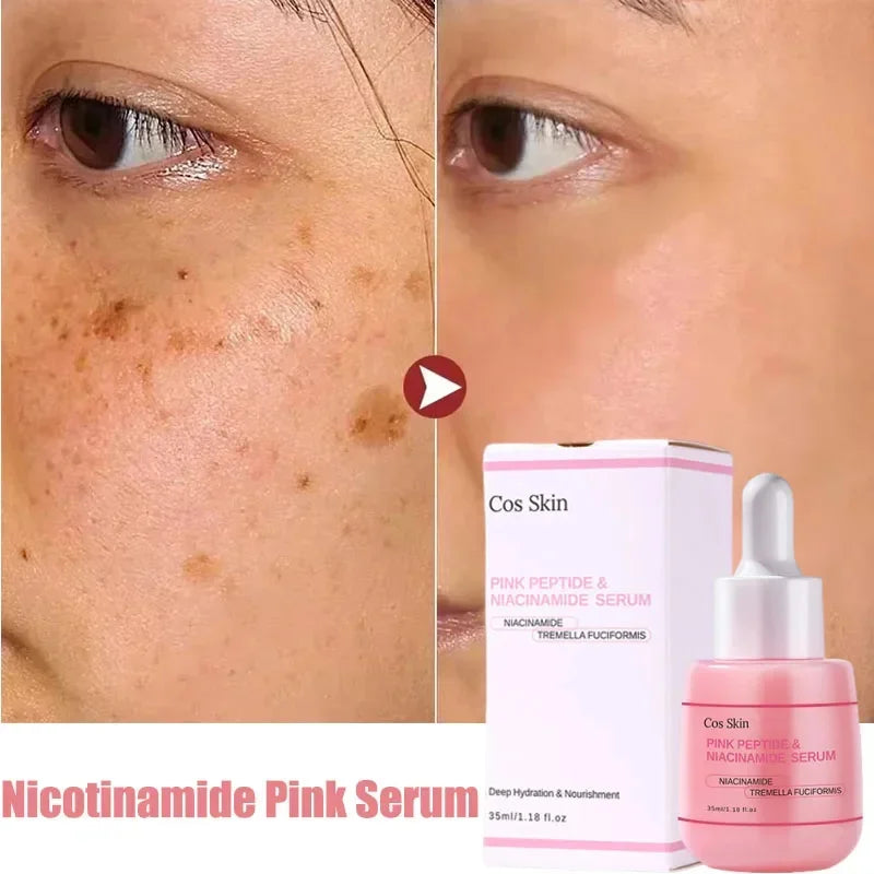 Niacinamide Dark Spot Remove Serum Face Freckle Melanin Correcting Moisturizing Brightening Anti Pigmentation Repair Skin Care